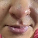 کلینیک فیشال و پاکسازی پوست تمیس