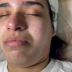 کلینیک فیشال و پاکسازی پوست تمیس