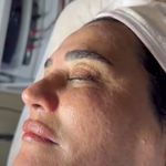 کلینیک فیشال و پاکسازی پوست تمیس