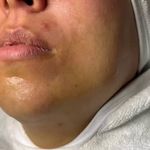 کلینیک فیشال و پاکسازی پوست تمیس