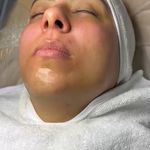 کلینیک فیشال و پاکسازی پوست تمیس