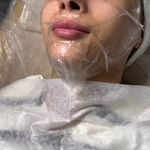 کلینیک فیشال و پاکسازی پوست تمیس