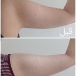 کلینیک تخصصی لاغری موضعی ولافیت