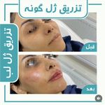 کلینیک لیزر و زیبایی لیلیا