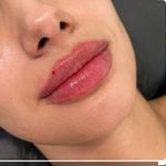 کلینیک پوست مو لیزر رومنس