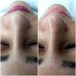 فیشال تخصصی و کلاسیک پوست نیکناز