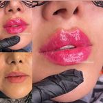 مطب زیبایی دکتر مهسا کاوئی