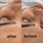 آکادمی  پوست و تناسب اندام ترمه(20% تخفیف)