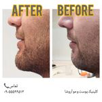 مرکز زیبایی,بوتاکس و لیزر آروشا