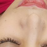 خدمات تخصصی پاکسازی پوست و فیشال مهسا