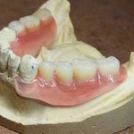 ساخت تخصصی دندان مصنوعی (ایران دنت)