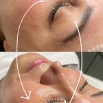 خدمات پاکسازی پوست و فیشال آرمی