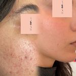 مرکز تخصصی لیزر و زیبایی و لاغری پیور
