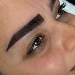 کاشت مو و ابرو