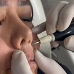 مركز ليزر و مطب زيبايی دكتر محمودآبادی