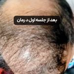 مرکز تخصصی اسکالپ تراپی (عارفه باقری)