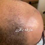 مرکز تخصصی اسکالپ تراپی (عارفه باقری)