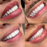 کلینیک پوست و زیبایی ژیلاوَش