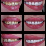 مطب دکترفاطمه متین فرددندانپزشکی زیبایی