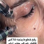 مرکز تخصصی فیشال و پاکسازی پوست حنانه