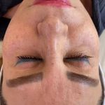 مرکز تخصصی فیشال و پاکسازی پوست حنانه