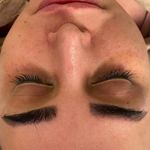 مرکز تخصصی فیشال و پاکسازی پوست حنانه