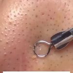 فیشال تخصصی و درمانی میسون 20درصد تخفیف