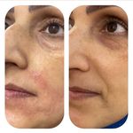 آکادمی رز :فیشال،ماساژ،،حانیه مهرپرور