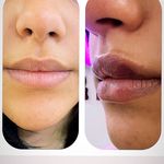 آکادمی رز :فیشال،ماساژ،،حانیه مهرپرور