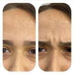 آکادمی رز :فیشال،ماساژ،،حانیه مهرپرور