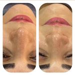 آکادمی رز :فیشال،ماساژ،،حانیه مهرپرور