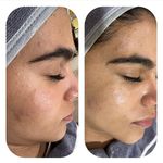 آکادمی رز :فیشال،ماساژ،،حانیه مهرپرور