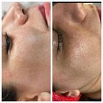 خدمات پاکسازی پوست کامرانی