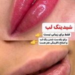 میکروکیماسی( میکروابرو چشم لب،ریمو)