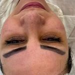 خدمات فیشیال و پاکسازی پوست