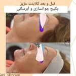 فیشال و پاکسازی تخصصی ساتی