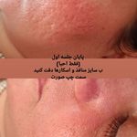خدمات تخصصی ودرمانی با سلولهای بنیادی