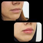 کلینیک پوست مو لیزر و لاغری عصر زیبایی