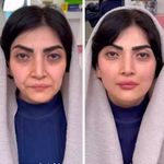 کلینیک زیبایی و لاغری آپیلنس