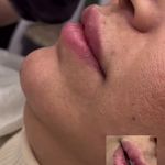 مرکز زیبایی و لاغری روژه