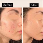 کلینیک فیشال و ماساژ سارن اسکین سارا