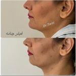 مرکز زیبایی دکتر فاطمه طرزی