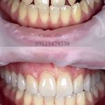کلینیک تخصصی دندانپزشکی و ایمپلنت الین