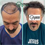 کلینیک پوست،زیبایی ولیزر وکاشت مو الماس