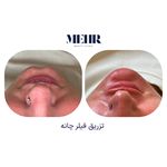کلینیک زیبایی مهر