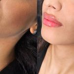 مطب زیبایی و لیزر دکتر امیرحسین متوسلیان