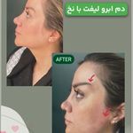 کلینیک پوست و مو و لیزر نیلوفر آبی