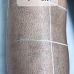 مطب لیزر و پوست و مو سابرینا شعبه نارمک