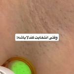 مطب لیزر و پوست و مو سابرینا شعبه نارمک