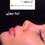 Tina Beauty Center|مرکز زیبایی تینابیوتی